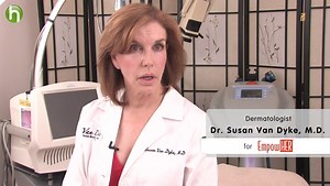 What do stretch marks look like and how can they be prevented and treated?