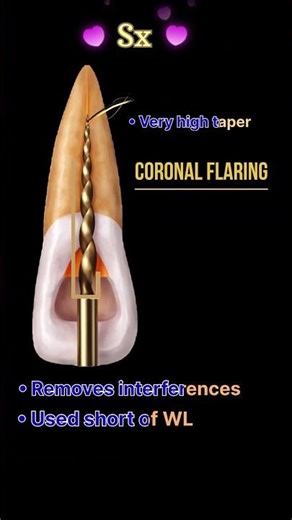 “ProTaper rotary canal preparation – crown-down technique.”| Dr.Dentique-hub