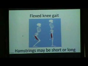 Lever arm dysfunction in CP