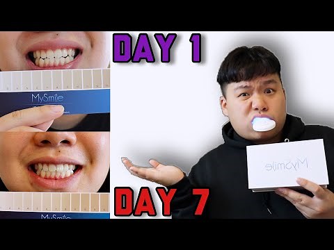 $30 MySmile Teeth Whitening Kit (Does It Even Work?)