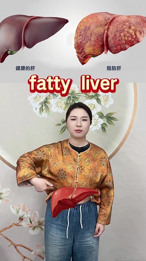 了解脂肪肝的中医治疗方法