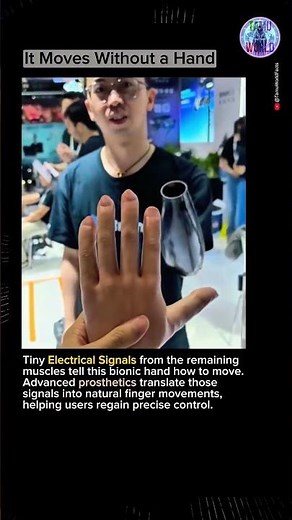 The Science of a Bionic Hand