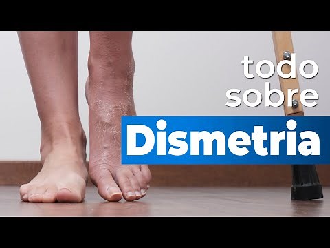 All about dysmetria