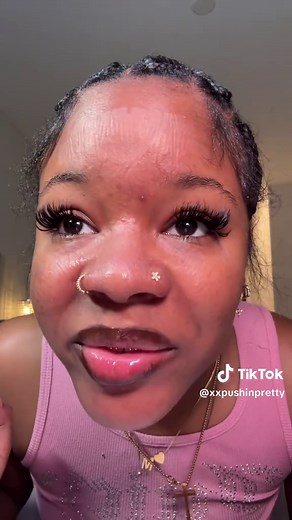Satisfying Acne Popping and Removal ASMR