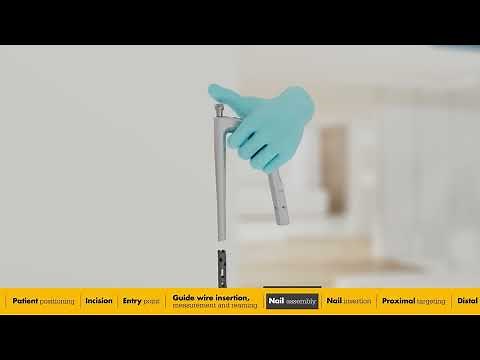 T2 Alpha Tibia Nailing System | Surgical Animation