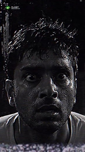 Синдром вибухаючої голови 😳 Феномен, який лякає людей Exploding Head Syndrome