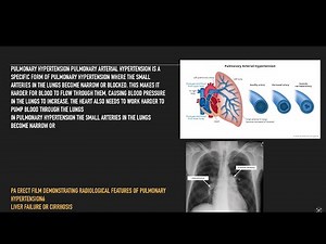 Peripheral oedema PART 1