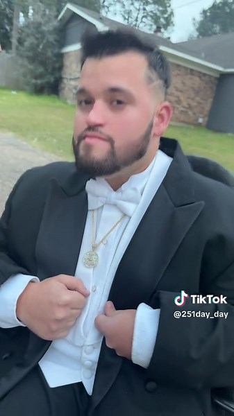 Celebrating Diversity: A Wheelchair Mardi Gras Party