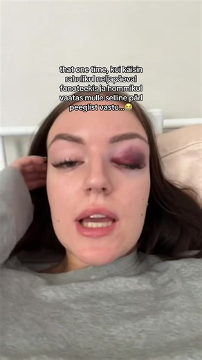 pean tunnistama, et see mind ei peatanud (kukkusin ikkagist laua otsa vist) #foruyou #tra #notoestinoh