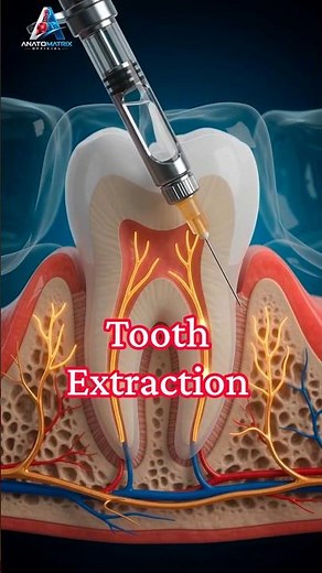 Tooth Extraction Explained 🦷 | Dental Surgery & 3D Animation