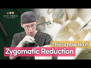 "Cheekbone Reduction Surgery: See How It's Actually Done! A Big Difference? [345 Plastic Surgery]"