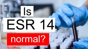 Is ESR 14 normal, high or low? What does ESR level 14 mean?