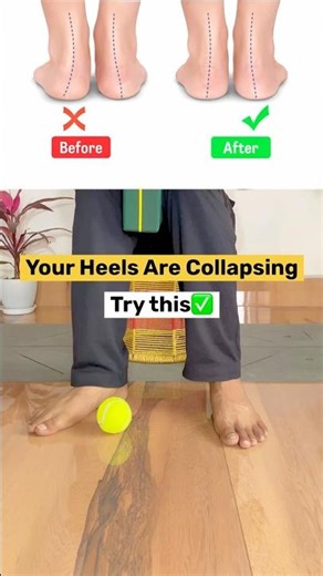 Your Heels Are Collapsing | Fix Flat Feet Before It Causes Knee Pain