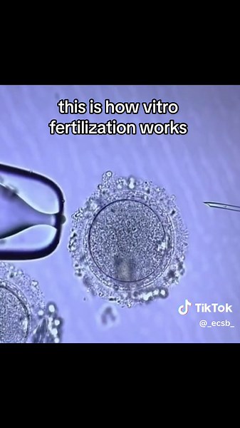 Understanding the Process of In Vitro Fertilization