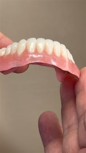 Hybrid Denture for Dr. Chris Davenport in Virginia