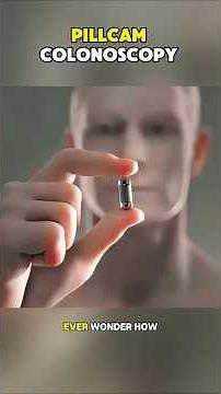 PILLCAM COLONOSCOPY
