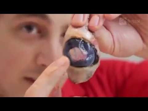 Eyeball Dissection - look inside the eyeball.