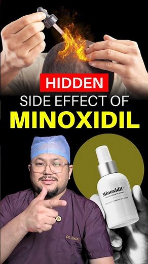 Minoxidil for Hair Growth Can Affect Your Eyes?