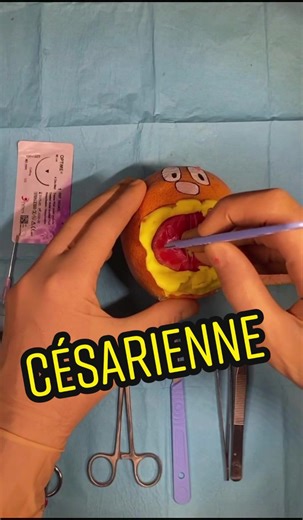 Accouchement en direct : la césarienne !