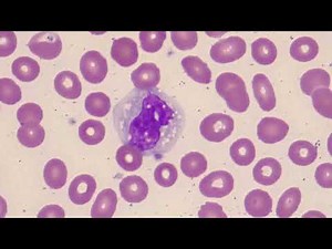Monocyte vs Lymphocyte