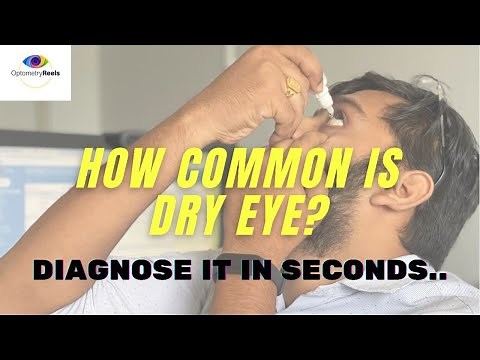 TBUT II Tear Film Breakup Time II Test for dry eyes