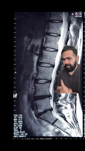 Improve Your Desk Posture to Alleviate Back Pain