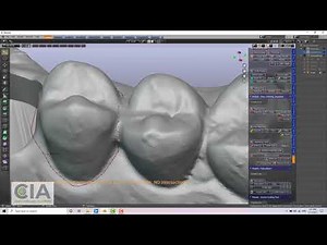 How to make your own tooth library from patient scans