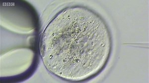 世界を揺るがす――分子の「はさみ」で遺伝子を編集 - BBCニュース