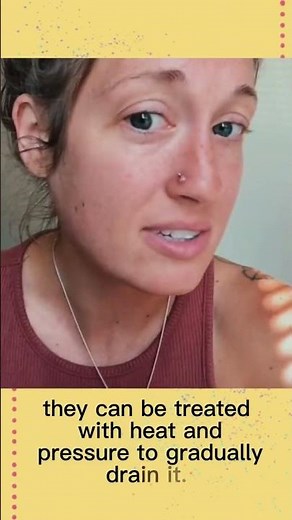 Nose Piercing Bump: What is it and How Do I Get Rid of it?