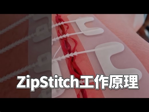 【中配】ZipStitch的工作原理😮 - Zack D. Films