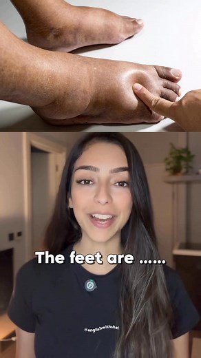 Do you know the last one? 🦶 🫧 Pruney fingers mean the skin has absorbed too much water or the moisture barrier is weakened. 💋 Chapped lips happen when dryness or dehydration strips away natural moisture. ❄️ Flaky skin shows that dead skin cells are shedding because of dryness or irritation. ✋ Calloused hands form when repeated friction makes the skin thicker to protect itself. 🦶 Cracked heels occur when dry, thick skin splits from pressure and lack of moisture. 💅 Brittle nails break easily 