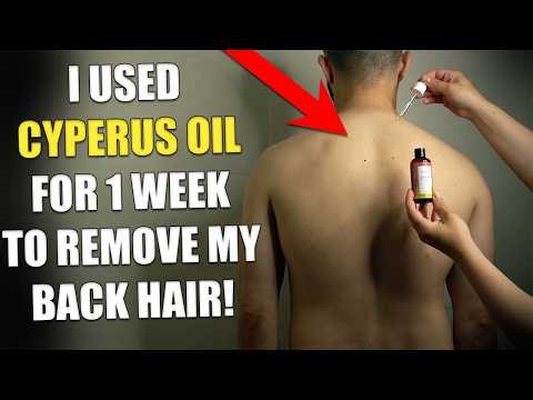 Cyperus Rotundus Oil 7-Day Honest Review - Did It Remove Hair From My Back? Before & After!