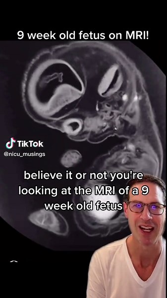 Exploring the Development of a 9-Week-Old Fetus