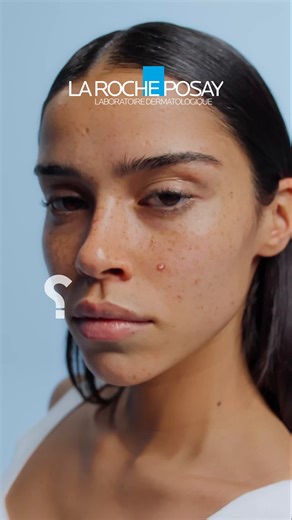 DON’T POP IT, PATCH IT! Meet the NEW Effaclar Duo M pimple patches from La Roche-Posay. Invisible on skin, and powered by hydrocolloid technology to absorb and protect. Clinically proven to start fading pimples in just 3 hours. ما تفرّقعهاش… حطلها باتش! جديد من لاروش بوزيه: EFFACLAR DUO M PATCH للحبوب. بسُمك 420 ميكرون، شفافة على البشرة، وبتكنولوجيا الهيدروكولويد اللي بتمتص وبتحمي. ومثبت فاعليتها إنها تبدأ تقلل مظهر الحبوب في 3 ساعات. | La Roche-Posay