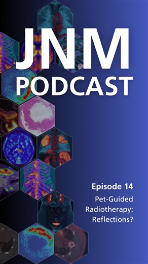 Society of Nuclear Medicine and Molecular Imaging on Instagram: "Being able to personalize a patient’s treatment is one of the cornerstones of nuclear medicine, but how are we able to do that? PET-Guided radiotherapy is one answer. In addition to staging and defining a disease, PET imaging can also give providers important information about what’s going on in the body while a patient is undergoing their treatment regimen. Learn more in Episode 14, where host Ken Herrmann talks with experts Nancy