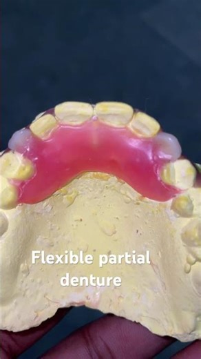 Flexible partial denture 😬😬😬#apexdental #dentistry #partialdenture #orthodontist #splittooth