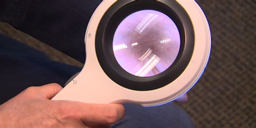 Melanoma most common cancer in women 25 to 29