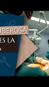 Plastic surgery for tuberous breasts