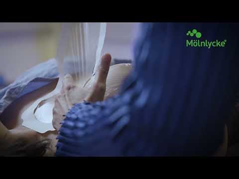 Mepitel® Film Application on Breast for Radiotherapy