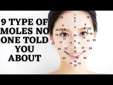 9 types of mole on your face| Facial Mole and body mole reading| Chinese Astrology