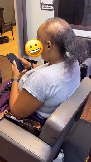 149K views · 153 reactions | ALOPECIA NEVER WINS‼️ DM the word...