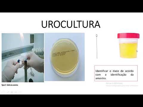 UROCULTURA