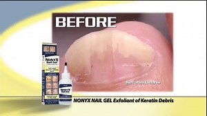 Xenna NonyX Nail Gel TV Spot, 'Wear Sandals Again'