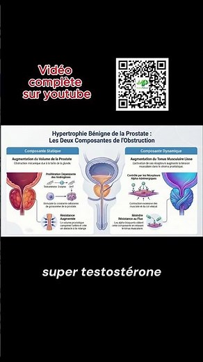 Physiopathologie de l’HBP : Composantes mécanique et dynamique