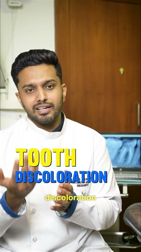Have you noticed any discoloration in your teeth lately?
