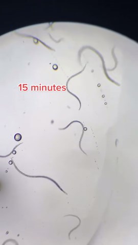 Microscope View: Purifying Nematodes One Drop at a Time