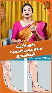 வெரிகோஸ் வெயின்களுக்கான ஆசனங்கள் | Dr.Jayaroopa |ASM INFO