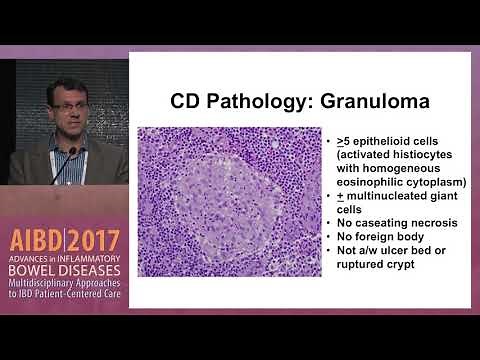 Use of endoscopy to evaluate esophageal, gastric, and duodenal Crohn’s disease