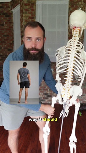 Your one-sided back pain is a hip problem