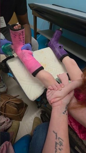 Satisfying Cast Removal After Leg Correction Surgery | Child Recovery Transformation 😱